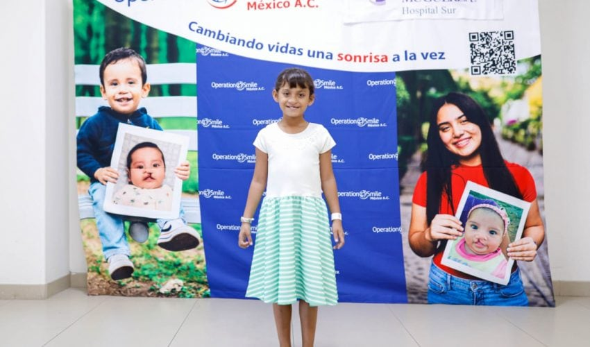 Realizan Fundación Smile y DIF Tamaulipas cirugías de paladar hendido y labio&nbsp;leporino